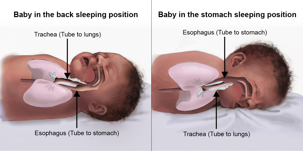 Diagram of child sleeping position